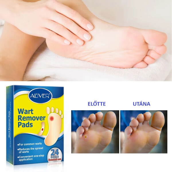 Wellife Plasture pentru negi 24 buc